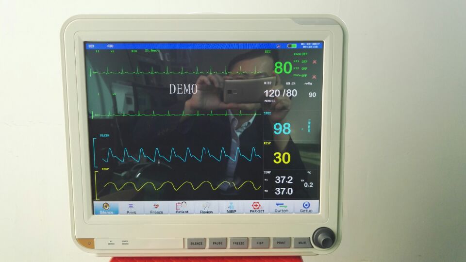 UT-J2000E 15 Inch Multi-para.Patient Monitor